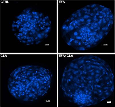Effects of Dietary Fatty Acids on Bovine <mark class="highlighted">Oocyte Competence</mark> and Granulosa Cells